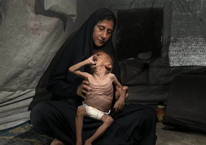 Woman gholding a very emaciated child who looks to be only skin and bones
